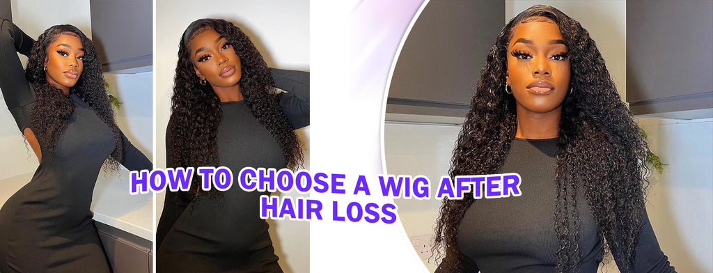How To Choose A Wig After Hair Loss