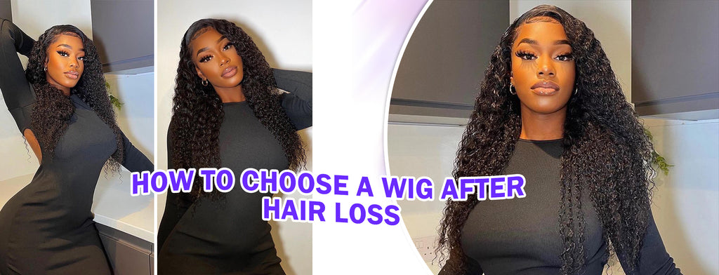 How To Choose A Wig After Hair Loss